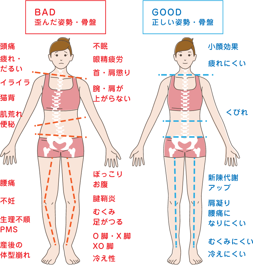 骨盤の状態が悪い状態と良い状態